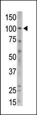 Anti-MVP Rabbit Polyclonal Antibody