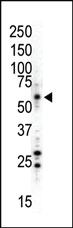 Anti-MAPK8 Rabbit Polyclonal Antibody