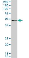 Anti-PAX8 Mouse Monoclonal Antibody [clone: 3H7]