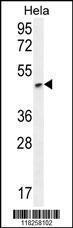 Anti-ANGPTL1 Rabbit Polyclonal Antibody