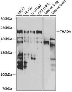 Western blot analysis of extracts of various cell lines, using Anti-THADA Antibody (A10065) at 1:1000 dilution