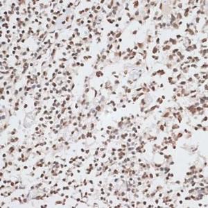 Immunohistochemistry analysis of paraffin-embedded human tonsil using Anti-Histone H2A.X Antibody (A80779) at a dilution of 1:100 (40X lens). Perform microwave antigen retrieval with 10 mM PBS buffer pH 7.2 before commencing with IHC staining protocol