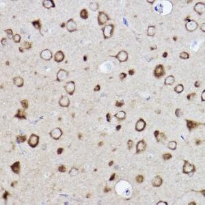 Immunohistochemistry analysis of paraffin-embedded rat brain using Anti-CARS Antibody [ARC2504] (A305788) at a dilution of 1:100 (40x lens). Perform high pressure antigen retrieval with 10 mM citrate buffer pH 6.0 before commencing with IHC staining protocol.