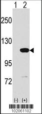 Anti-MVP Rabbit Polyclonal Antibody