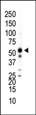 Anti-MAPK9 Rabbit Polyclonal Antibody