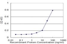 Anti-PAX8 Mouse Monoclonal Antibody [clone: 3H7]