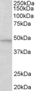 EB11391 (0.5 µg/ml) staining of Human Cerebellum lysate (35 µg protein in RIPA buffer). Primary incubation was 1 hour. Detected by chemiluminescence.