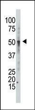 Anti-GCNT1 Rabbit Polyclonal Antibody (FITC (Fluorescein))