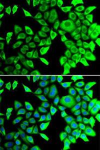 Immunofluorescence analysis of A549 cells using Anti-THADA Antibody (A10065). DAPI was used to stain the cell nuclei (blue)