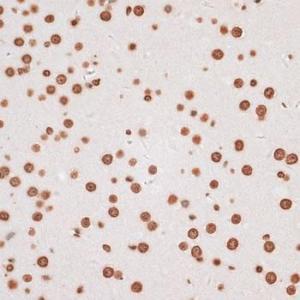 Immunohistochemistry analysis of paraffin-embedded mouse brain using Anti-Histone H2A.X Antibody (A80779) at a dilution of 1:100 (40X lens). Perform microwave antigen retrieval with 10 mM PBS buffer pH 7.2 before commencing with IHC staining protocol