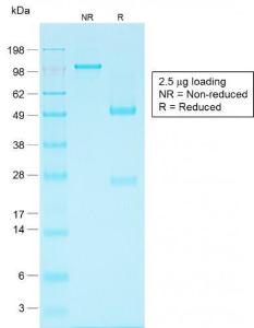 SDS-PAGE analysis of Anti-EpCAM Antibody [EGP40/1556R] under non-reduced and reduced conditions; showing intact IgG and intact heavy and light chains, respectively. SDS-PAGE analysis confirms the integrity and purity of the antibody.