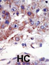 Anti-MAPK9 Rabbit Polyclonal Antibody