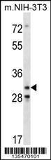 Anti-CDK4 Rabbit Polyclonal Antibody (FITC (Fluorescein Isothiocyanate))