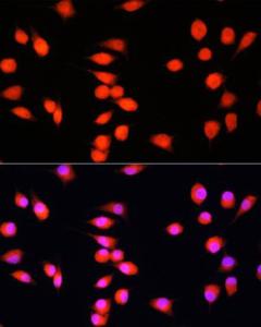 Immunofluorescence analysis of L929 cells using Anti-COMMD1/MURR1 Antibody (A10068) at a dilution of 1:100. DAPI was used to stain the cell nuclei (blue)