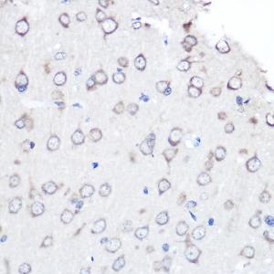 Immunohistochemistry analysis of paraffin-embedded rat brain using Anti-FGF2 Antibody [ARC0618] (A308407) at a dilution of 1:100 (40x lens) Perform microwave antigen retrieval with 10 mM PBS buffer pH 72 before commencing with IHC staining protocol