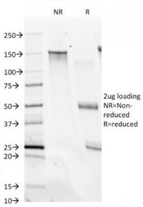 SDS-PAGE analysis of Anti-CD28 Antibody [C28/74] under non-reduced and reduced conditions; showing intact IgG and intact heavy and light chains, respectively SDS-PAGE analysis confirms the integrity and purity of the antibody