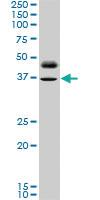 Anti-PAX8 Mouse Monoclonal Antibody [clone: 3G11]