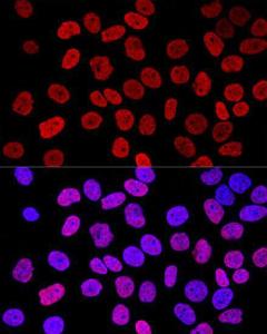 Confocal immunofluorescence analysis of HeLa cells using Anti-Histone H2A.X Antibody (A80779) at a dilution of 1:400. DAPI was used to stain the cell nuclei (blue)