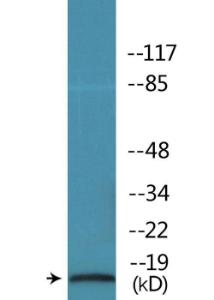 Western blot analysis of lysates from COS7 cells treated with nocodazole 1µg/ml 16h using Anti-STMN1 (phospho Ser62) Antibody