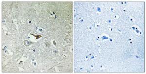 Immunohistochemical analysis of paraffin-embedded human brain tissue using Anti-CCR5 Antibody. The right hand panel represents a negative control, where the antibody was pre-incubated with the immunising peptide