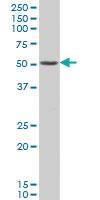 Anti-PAX8 Mouse Monoclonal Antibody [clone: 3G11]