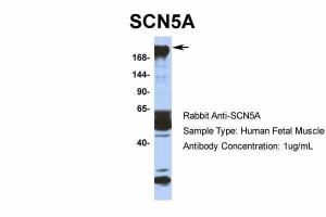 Anti-SCN5A Rabbit Polyclonal Antibody