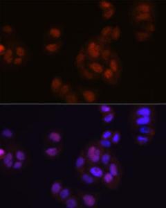 Immunofluorescence analysis of HeLa cells using Anti-FGF2 Antibody [ARC0618] (A308407) at a dilution of 1:100 (40x lens) DAPI was used to stain the cell nuclei (blue)