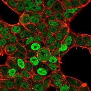 Immunofluorescent analysis of PFA-fixed MCF-7 cells stained with Anti-QKI Antibody [PCRP-QKI-2F10] followed by Goat Anti-Mouse IgG (CF and #174; 488) (Green). CF and #174; 640R Phalloidin (Red)