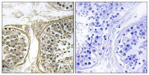 Immunohistochemical analysis of paraffin-embedded human testis using Anti-Cytochrome P450 2C8 Antibody. The right hand panel represents a negative control, where the antibody was pre-incubated with the immunising peptide