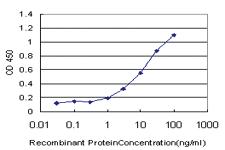 Anti-PAX8 Mouse Monoclonal Antibody [clone: 3G11]