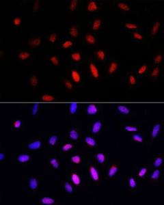 Immunofluorescence analysis of U2OS cells using Anti-COMMD1/MURR1 Antibody (A10068) at a dilution of 1:100. DAPI was used to stain the cell nuclei (blue)