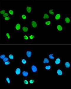 Confocal immunofluorescence analysis of U-2 OS cells using Anti-Histone H2A.X Antibody (A80779) at a dilution of 1:400. DAPI was used to stain the cell nuclei (blue)