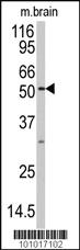 Anti-MAPK10 Rabbit Polyclonal Antibody