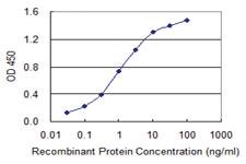 Anti-ABLIM1 Mouse Monoclonal Antibody [clone: 3A1]