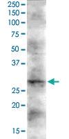 Anti-DKK2 Goat Polyclonal Antibody