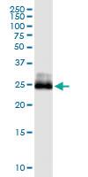 Anti-CITED1 Antibody Pair