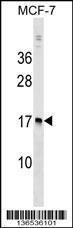 Anti-NUDT4 Rabbit Polyclonal Antibody (APC (Allophycocyanin))