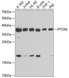 Western blot analysis of extracts of various cell lines, using Anti-PTCRA Antibody (A10069) at 1:1,000 dilution