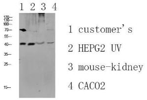 Western blot analysis of various lysate using Anti-CCR5 Antibody