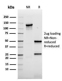 SDS-PAGE analysis of Anti-AKT1 Antibody [rAKT1/2491] under non-reduced and reduced conditions; showing intact IgG and intact heavy and light chains, respectively. SDS-PAGE analysis confirms the integrity and purity of the antibody