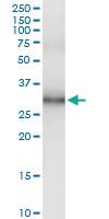 Anti-IL32 Polyclonal Antibody Pair