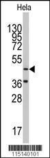 Anti-Asparaginyl-tRNA Synthetase 2, Mitochondrial Rabbit polyclonal antibody unconjugated