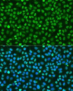 Immunofluorescence analysis of U2OS cells using Anti-Histone H2A.X Antibody (A80779) at dilution of 100 (40X lens). DAPI was used to stain the cell nuclei (blue)