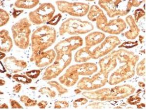 Immunohistochemical analysis of formalin-fixed, paraffin-embedded human kidney tissue using Anti-AKR1B1 Antibody [AKR1B1/7009R]