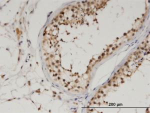 Anti-UBA6 Mouse Monoclonal Antibody [clone: 1D11]