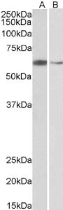 EB05813 (2 µg/ml) staining of Hela (A) and K562 (B) nuclear lysates (35 µg protein in RIPA buffer). Primary incubation was 1 hour. Detected by chemiluminescence.