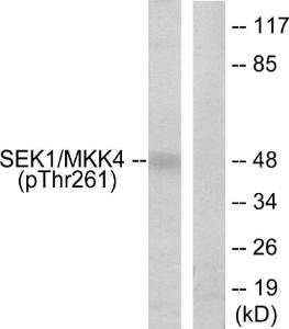 Western blot analysis of lysates from 293 cells treated with UV 15' using Anti-SEK1 (phospho Thr261) Antibody. The right hand lane represents a negative control, where the antibody is blocked by the immunising peptide