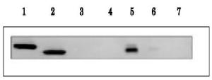 Anti-Ferredoxin-1 Antibody