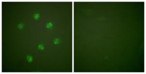 Immunofluorescence analysis of COS7 cells using Anti-Ki67 Antibody. The right hand panel represents a negative control, where the antibody was pre-incubated with the immunising peptide.