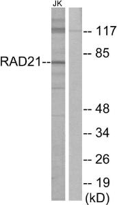 Western blot analysis of lysates from Jurkat cells using Anti-RAD21 Antibody. The right hand lane represents a negative control, where the antibody is blocked by the immunising peptide.